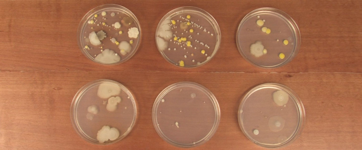 Microbiology - Culture Medium : - Nutrients prepared for microbial